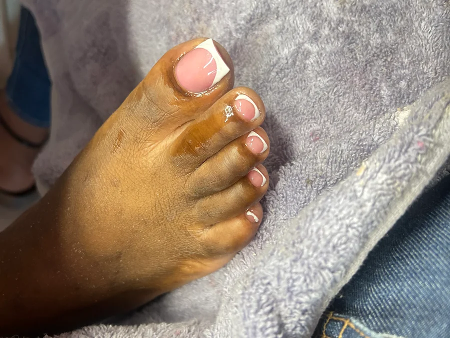 Acrylic toes