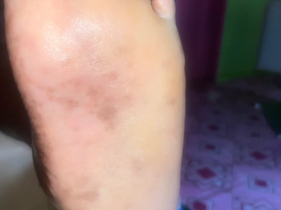 Pedicure ( male )