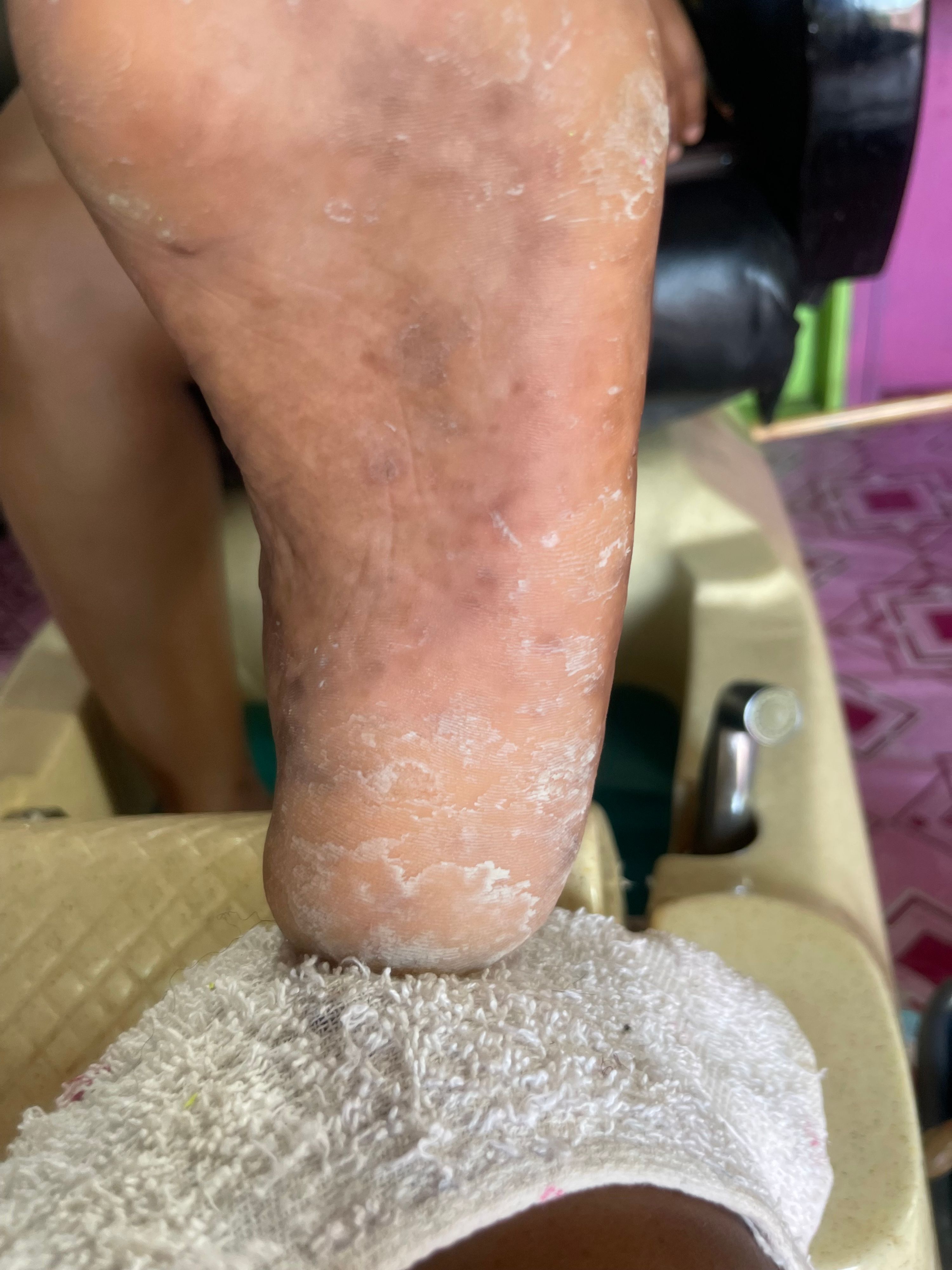 Gel pedicure with callus removal 
