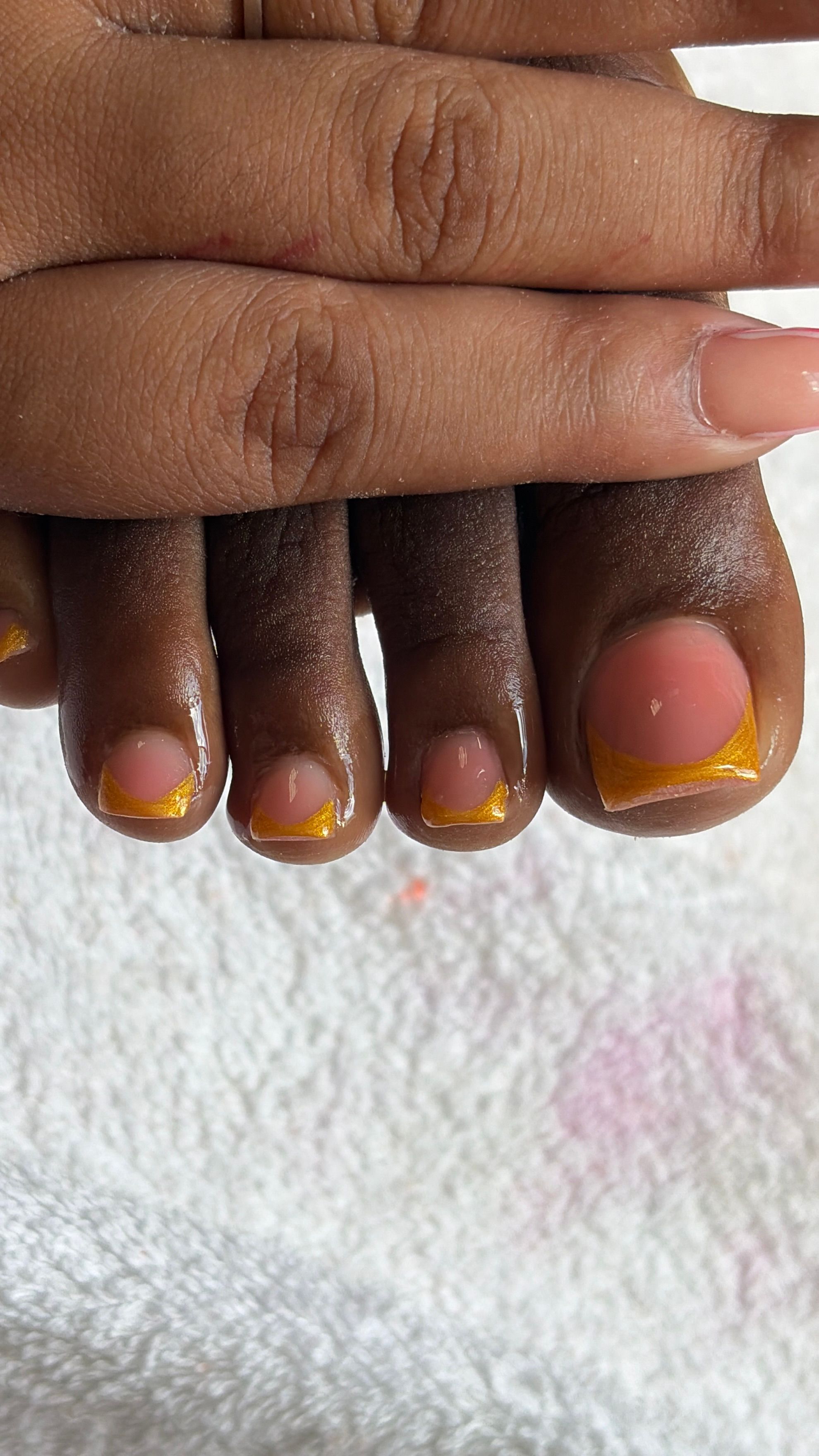 Acrylic on big toe