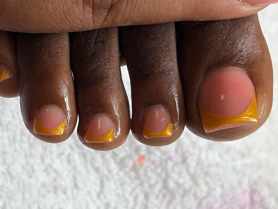 Acrylic on big toe